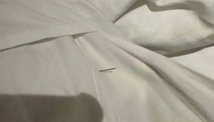 网友称女儿被酒店枕头里的针扎伤,酒店:已报警