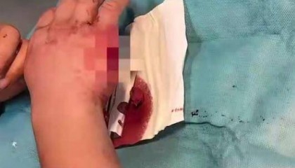 手部外伤被要求检查前列腺?网友吐槽宜兴一医院不合理检查,多方回应