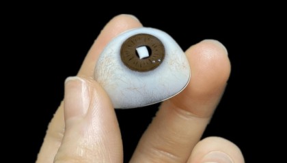 义眼片的种类和价格(义眼片的价格)