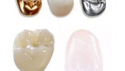 珠海假牙價格​：假牙的種類及其價格